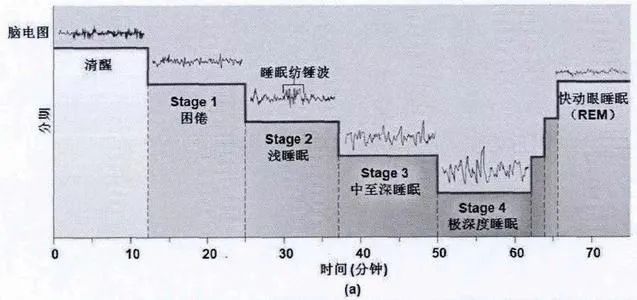 做梦算深度睡眠的表现吗 (做梦算深度睡眠的体现吗 如何判别深度睡眠)