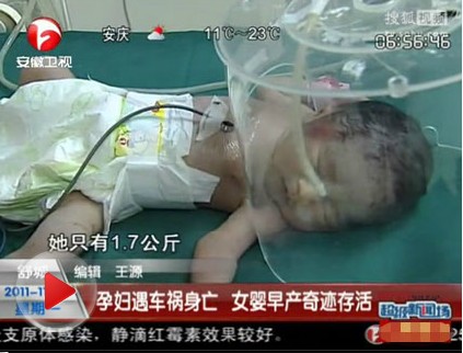 孕妇做梦梦到把蛇踩死了