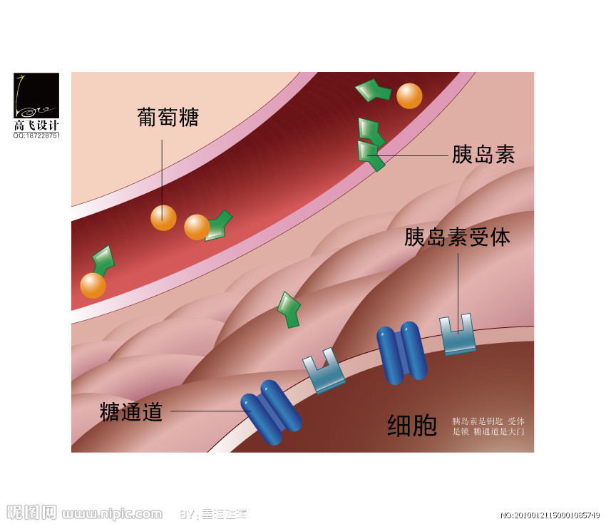 查胰岛素配置怎样查 如何判别胰岛素抵制