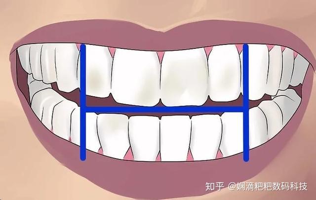 电动牙刷正确刷牙方法视频教程 (电动牙刷正确经常使用方法 电动牙刷的用法引见)