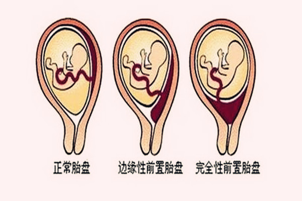 为什么男好友不能送女好友伞 男友送伞不吉利谈谈送礼的文明含意